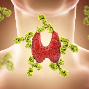 Read more about the article When the Thyroid Rides Along